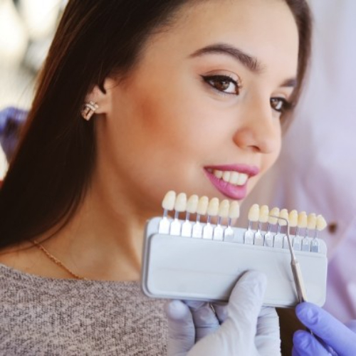 Dental veneers in sahakar nagar, dentists with veneers in sahakara nagar, permanent dental veneers in sahakarnagar, porcelain veneers in sahakar nagar, treatment for fractured teeth in sahakarnagar