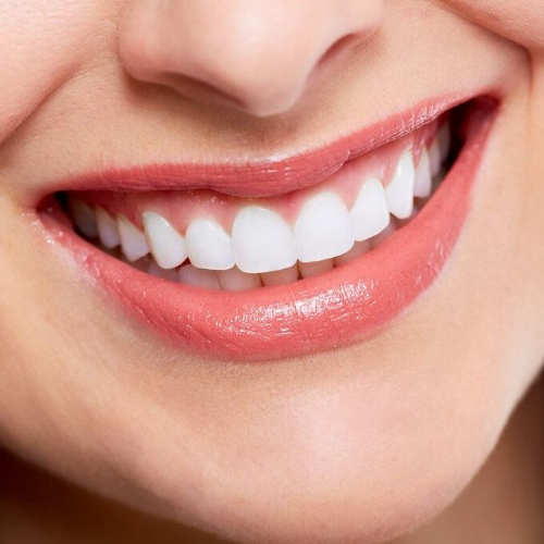 dental crown fixing services in sahakara nagar, dental crowns and bridges in sahakarnagar, dental crowns cost in sahakara nagar, dental crowns treatment in sahakarnagar, porcelain crowns sahakarnagar